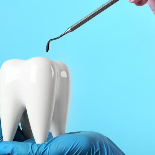 How You Know you have a cavity.