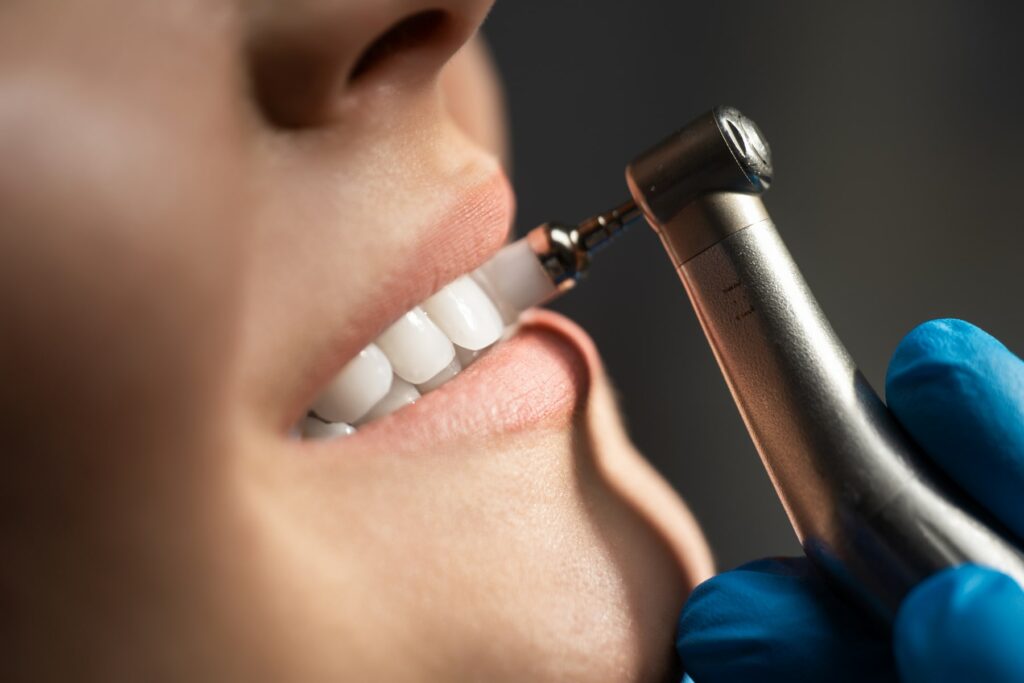 Dental Cleaning and Exams