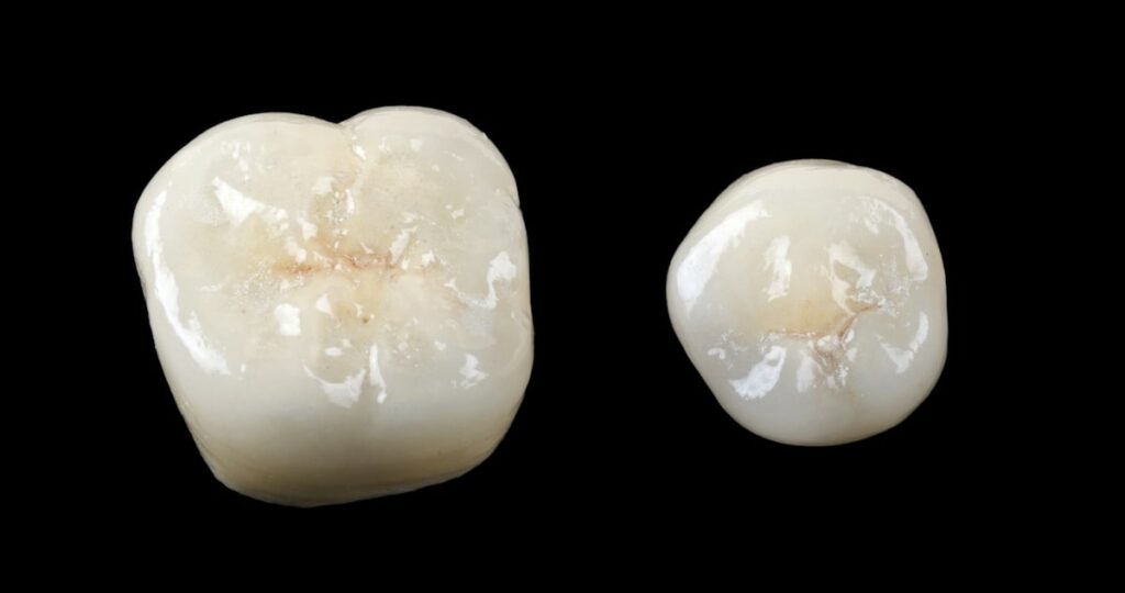 Dental Crowns