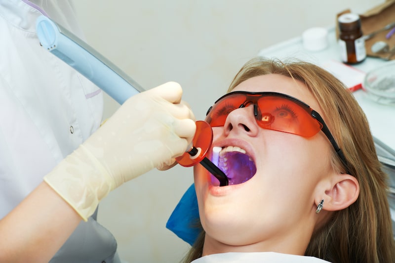 Dental fillings and restoration